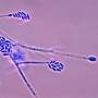 fusarium_verticillioides.jpg