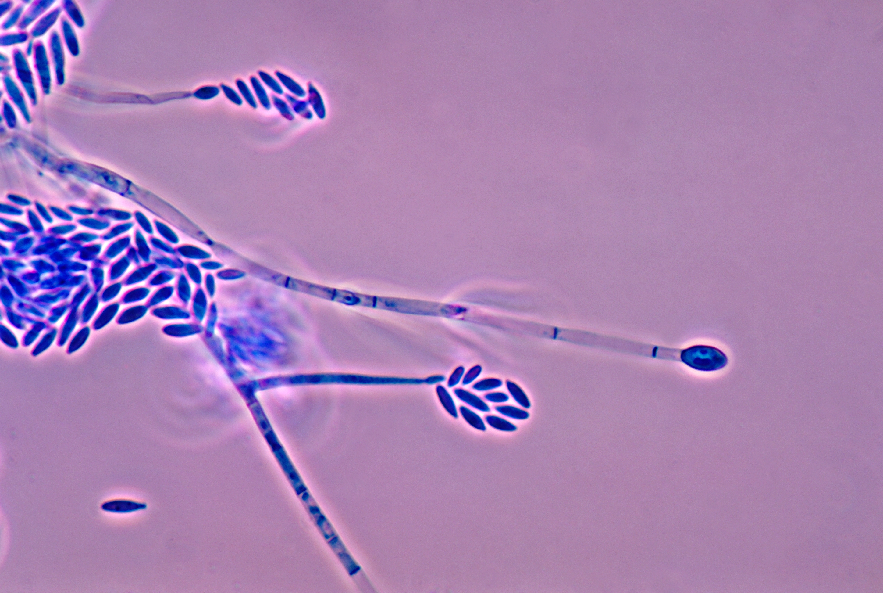 fusarium_verticillioides.jpg